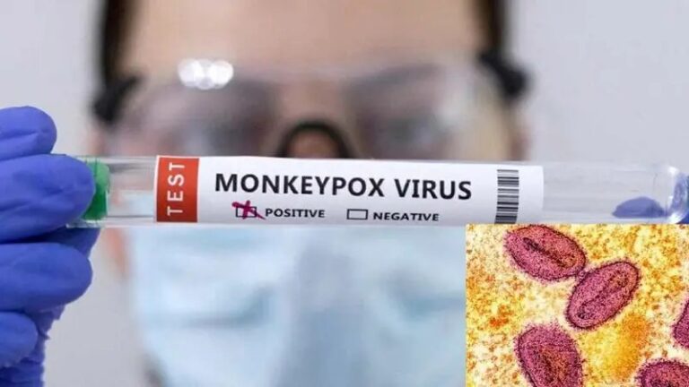 1-பி வகை குரங்கம்மை பாதிப்பு: கேரளாவில் முதல் பதிவு